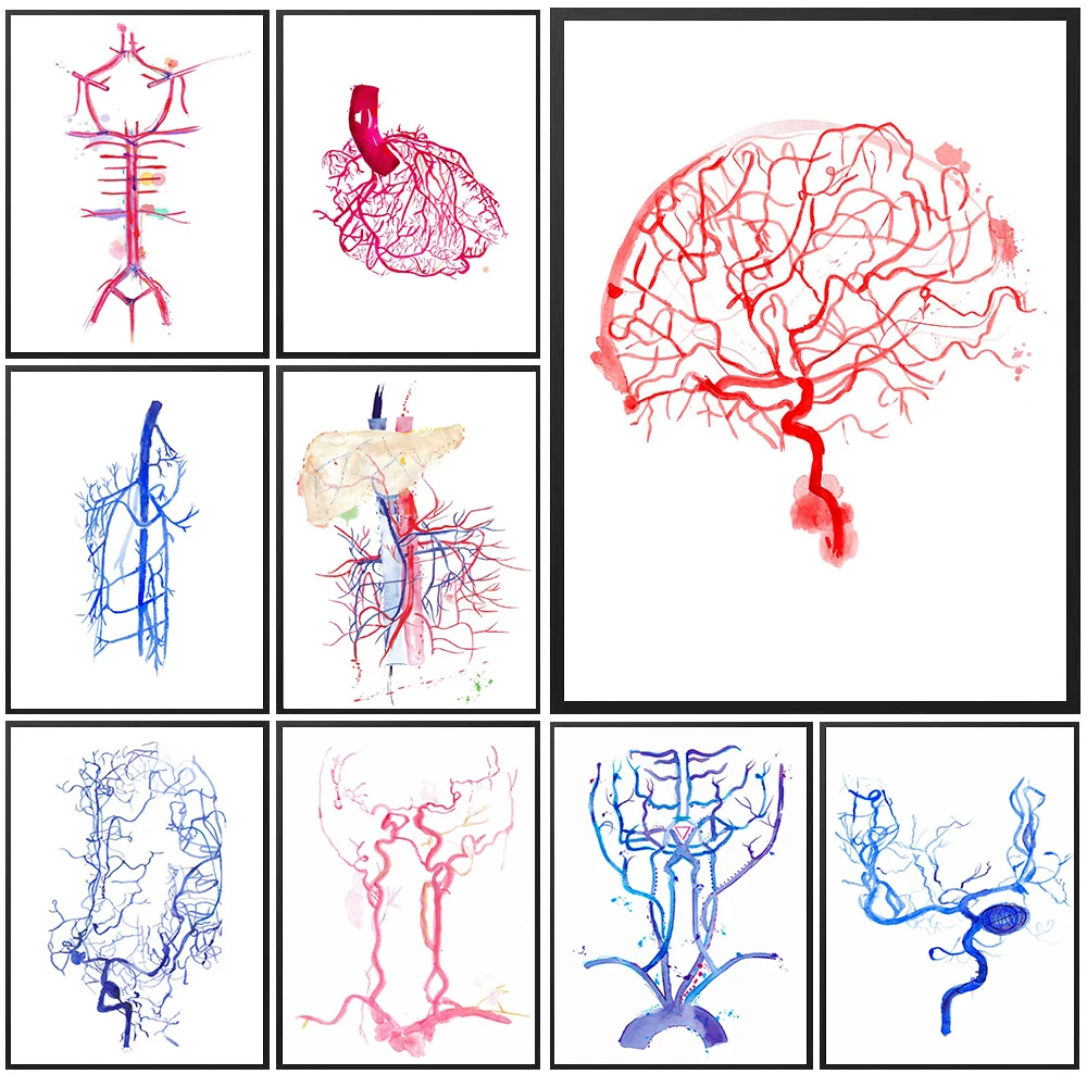 Watercolor Cerebral Vascular Anatomy Canvas Painting,Medical Brain Blood Vessel Wall Art,Colorful Neurology Poster Print Decor