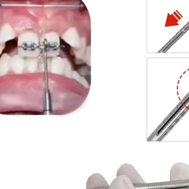 

Dental Orthodontic Dynamometer Stress Tension Meter for Elastic Bands Stainless Steel Force Gauge Oral Measurement Tools