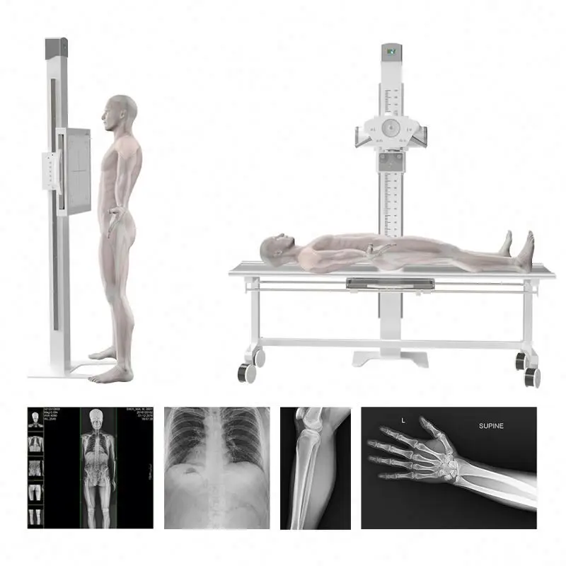 OEM/ODM CE Certified 20kw Medical Radiography Diagnostic Double Column X-Ray Machine for Hospital Use