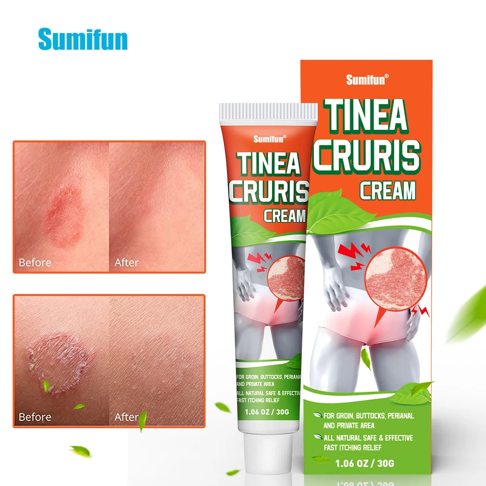 

1/2/3/5Pcs Tinea Cruris Treatment Anti-Itch Chinese Medicine Herbal Antipruritic Ointment Skin Itching Antibacterial Daily Care