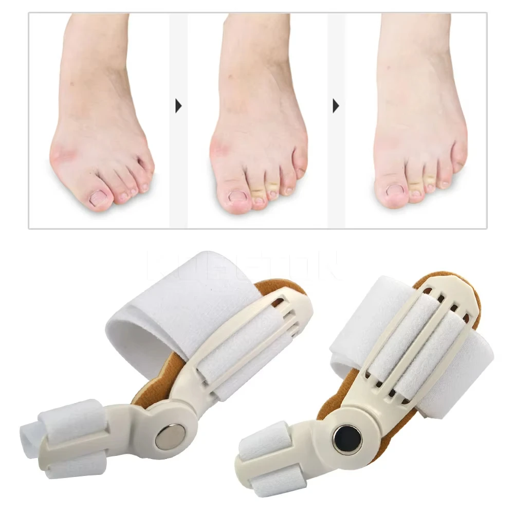 1/2Pcs Big Bone Toe Bunion Splint Straightener Corrector Foot For Feet Care Hallux Valgus Protector Pain Relief Foot Care Tools