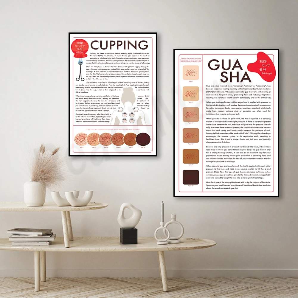 Cupping Poster, Gua Sha Poster Healthy Body Massage Spa Beauty Salon Wall Art Canvas Poster Picture HD Painting Home Decoration