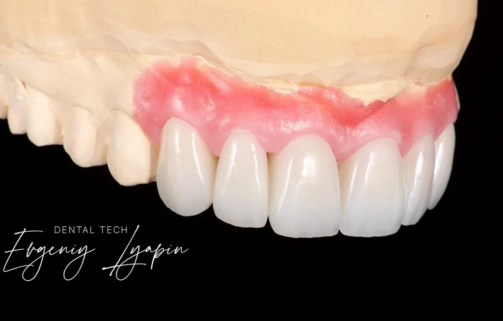 Multilayer-3D Zirconia Block 98mm Thickness 18mm Translucency 46-49% Bending Strength 700-1100 Mpa Vita 16 and Bleach Colors