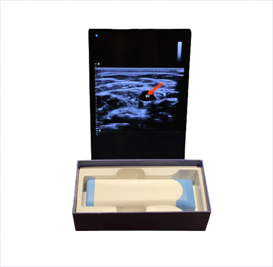 Portable Wireless Mini Wi-Fi Doppler Ultrasound Scanner For Android & IOS Linear Ultrasonic Transducer Electric Power Source