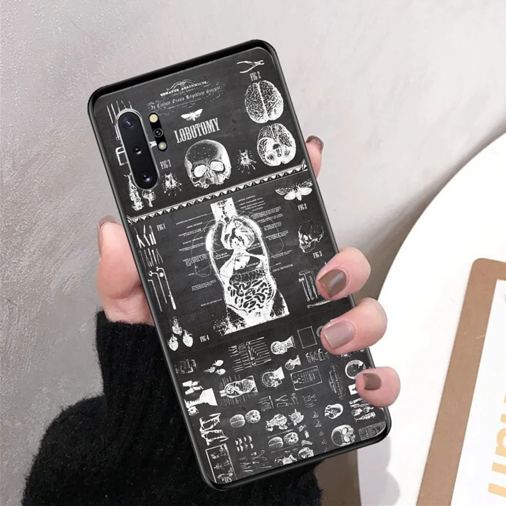 Radiological human organs Skeleton Phone Case For Samsung Note 8 9 10 20 pro plus lite M 10 11 20 30 21 31 51 A 21 22 42 02 03