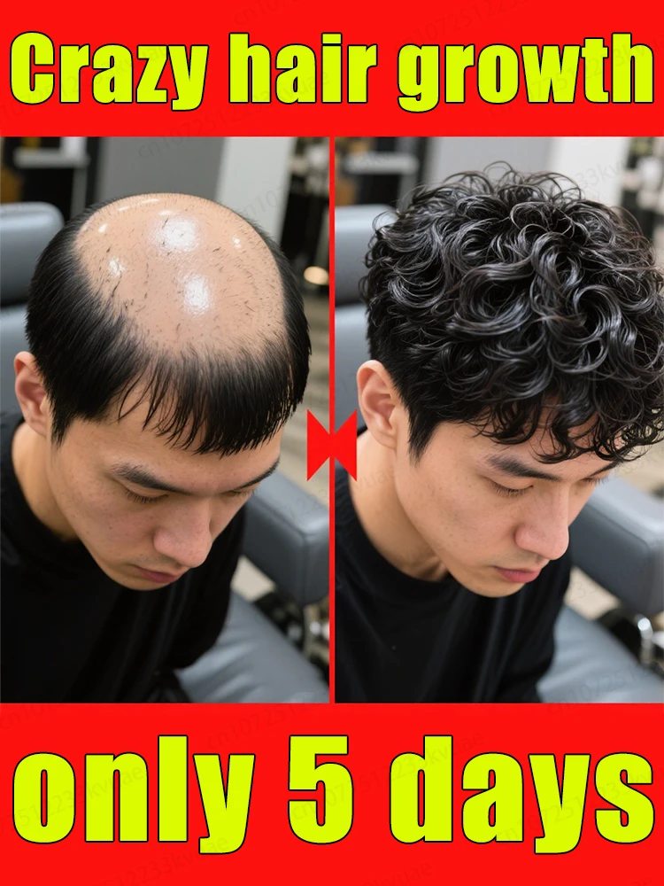 

Сделайте росту волос снова