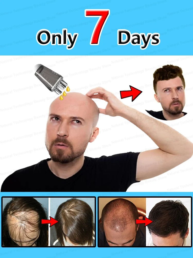 Solve your hair problems