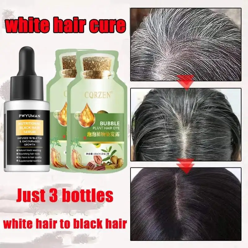 White Hair Treatment Essence Repairs Natural Color Prevents Gray Hair Shampoos  Anti Loss Hair Rgrowth Men Women Care Products