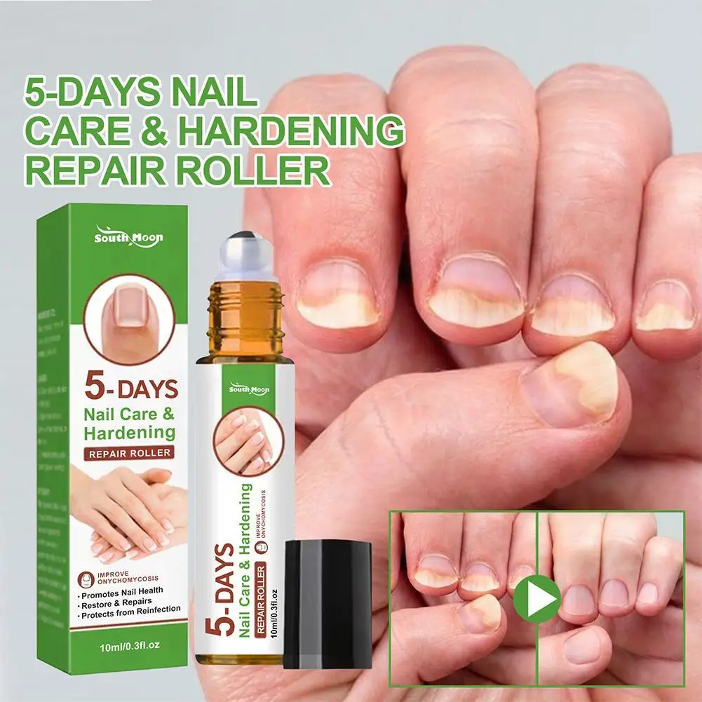 5 Days Nail Growth And Hardening Repair Roller Nail Nail Solution Nail Nutrient Thickening Repair Brightening Softening Rem S0V9