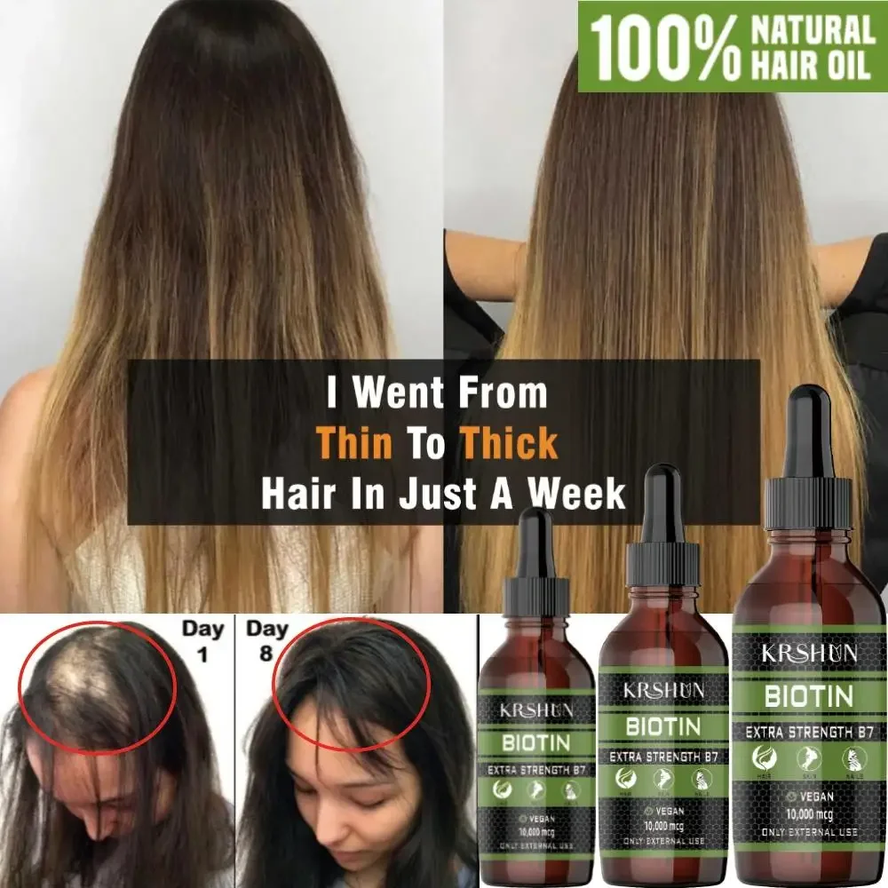 Biotin Hair Fast Growth Oil Regrowth Serum Hair Thinning Treatment Head Care Products Liquid Anti-Hair Loss for Women & Men