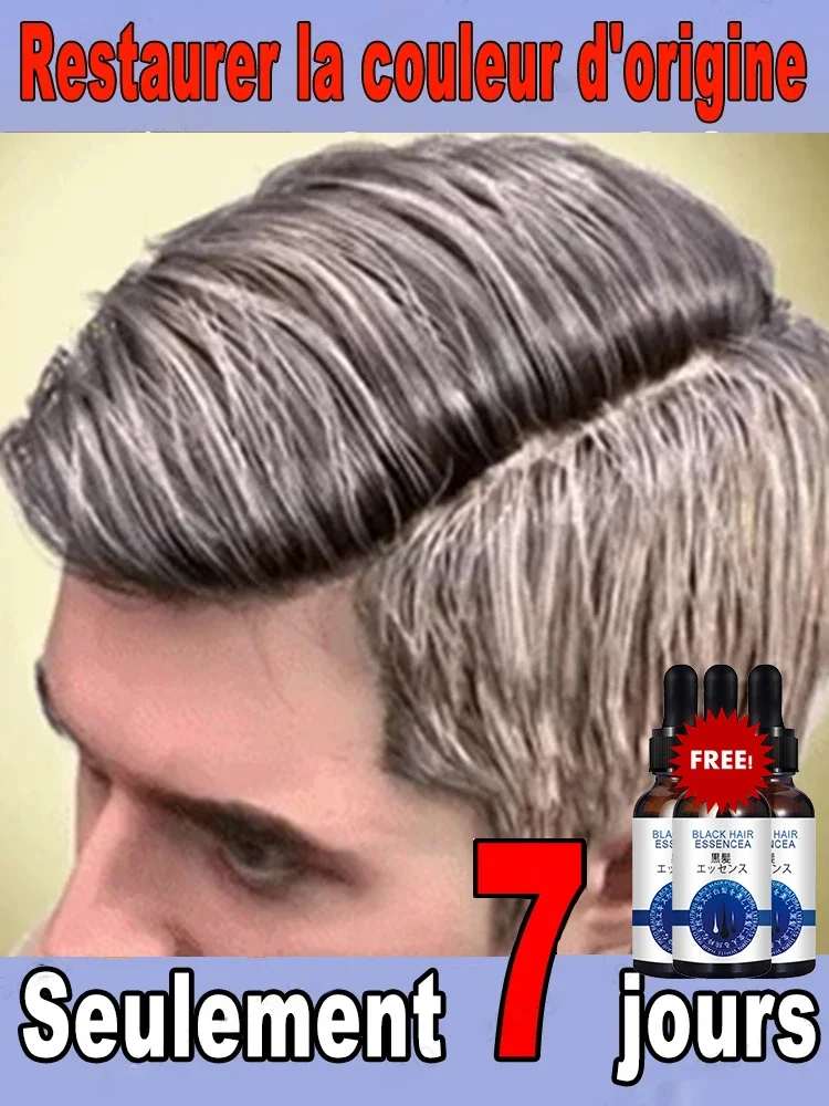 

White hair killer, remove gray hair and restore natural hair color in 7 days