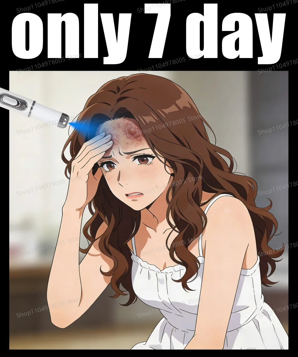 The blue light pen is suitable for removing warts.Take care of your physical health