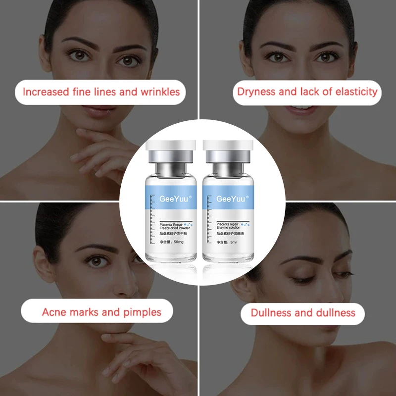 Placenta polipeptide polvere liofilizzata essenza riparazione viso idratante nutriente restringimento dei pori pelle ringiovanire la cura della pelle