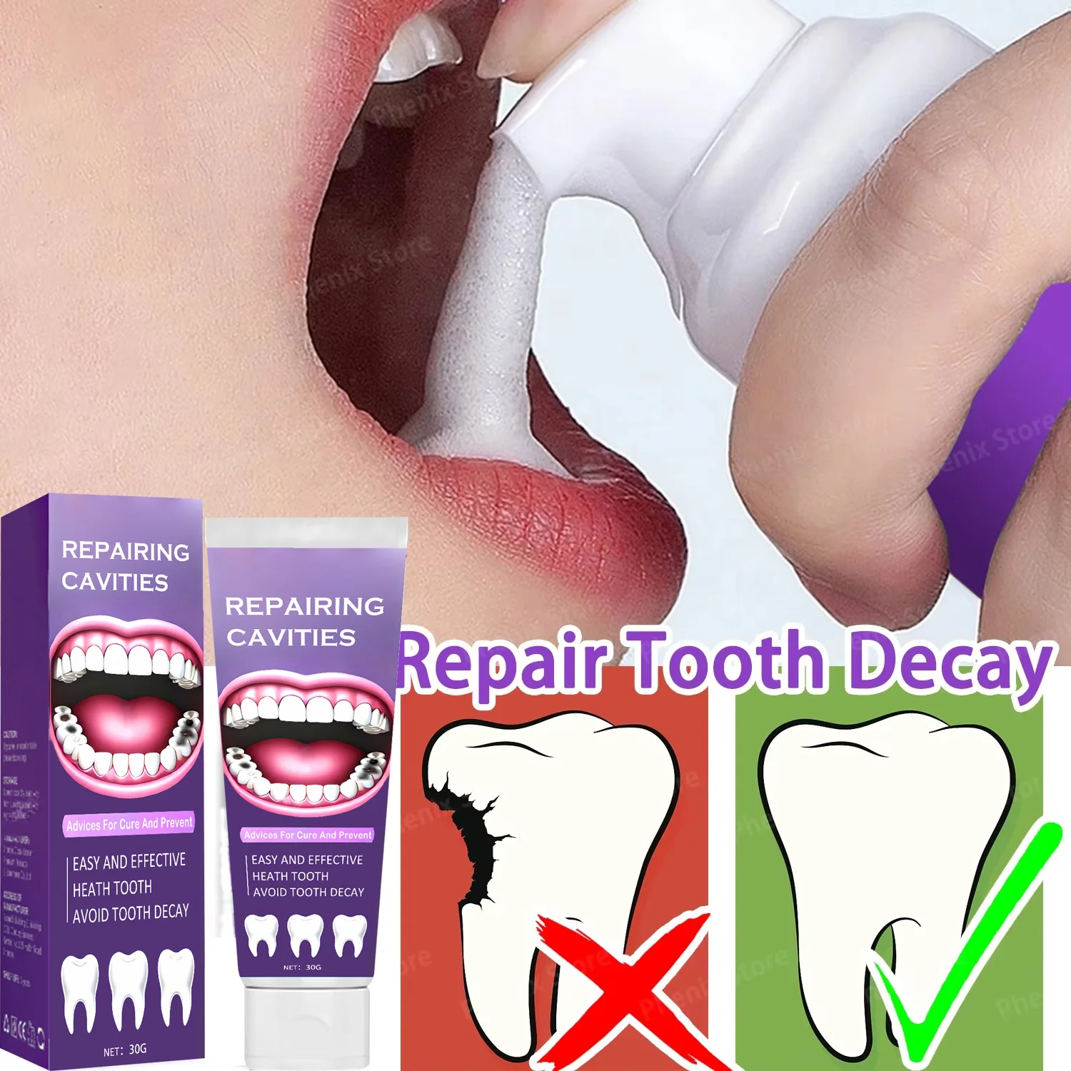 Suero de reparación de Caries dentales, previene la Caries, protege los dientes, elimina la placa, limpieza bucal, extracto de hierbas naturales, 30ml