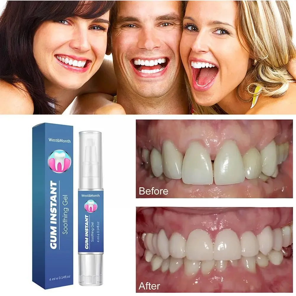 Heallor Gum Soothing Gel Relieve Mouth Sores Blisters Periodontal Treatment Antibacteria Gum Care Pain Pharyngitis Oral Clean 4m