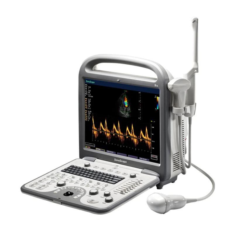 Most popular cardiac ultrasound machine Sonoscape S8 Portable Color ultrasound scanner