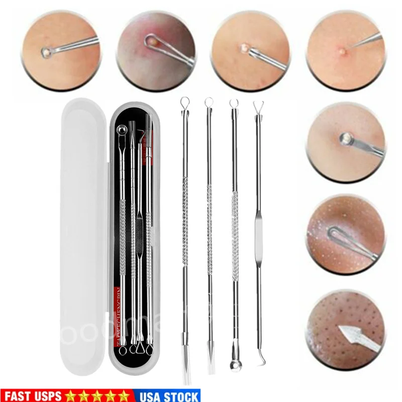 4Pcs Blackhead Acne Needles Remover Set Pore Cleaner Stainless Steel Pimple Needles Pore Cleanser Removal Tools Skin Care