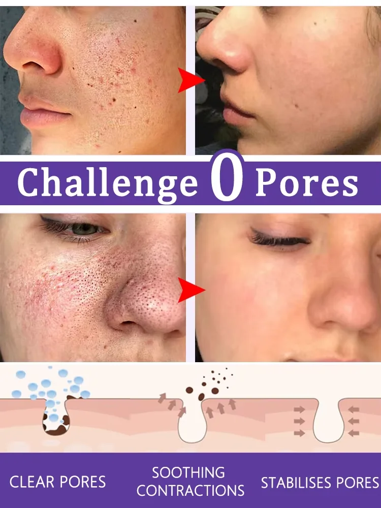 7 dagen om je een plat en glad gezicht te geven