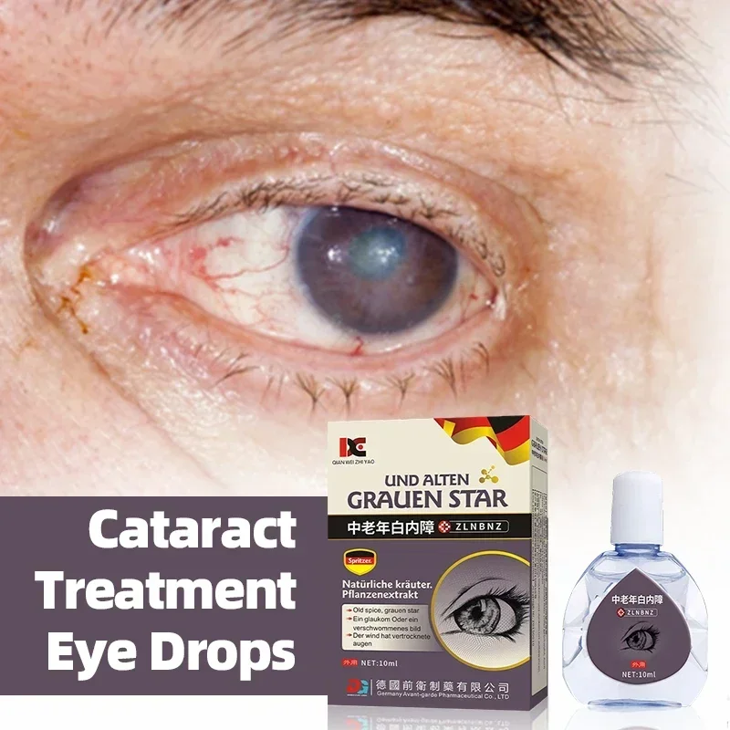 Cataract Treatment Eye Drops For Dry Itchy Eyes Pain Fatigue Removal Cleaner Blurred Vision Medicine German Secret Recipe