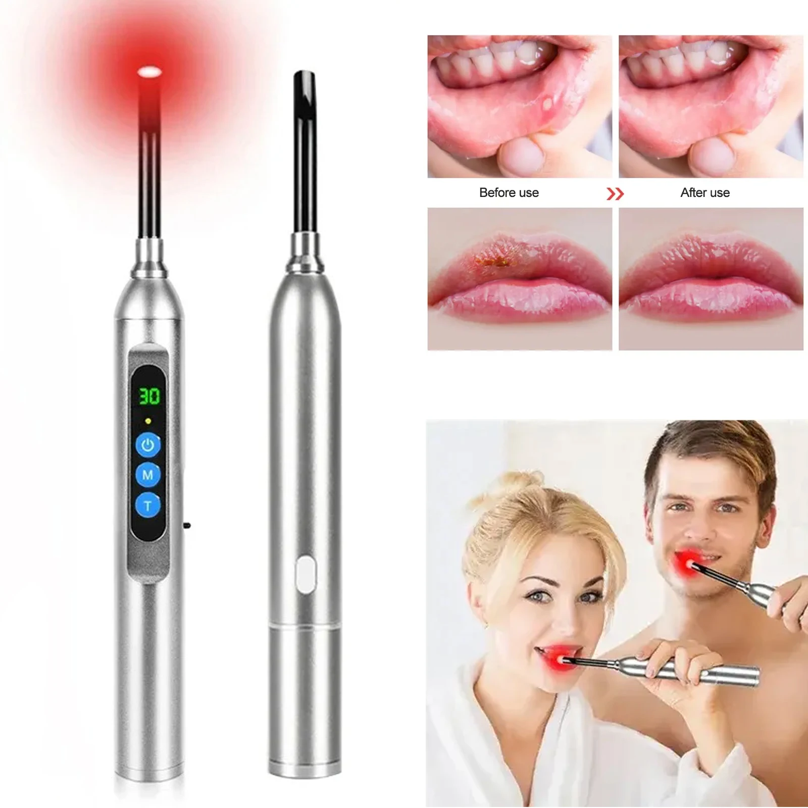 Dispositivo de Terapia de Luz Roja para el Tratamiento de Herpes Labial y Herpes Fácil, Varita de Terapia de Luz Infrarroja para Boca, Nariz, Oreja, Rodilla, Pies, Manos y Tobillo