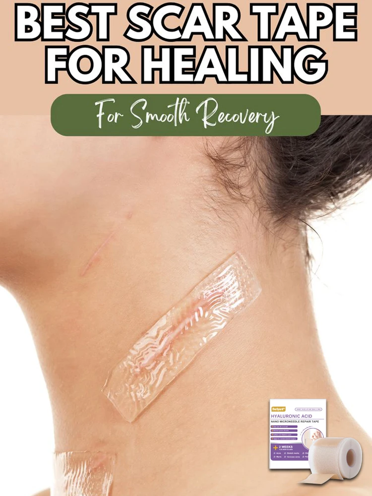 

1 Roll Silicone Scar Sheets , 4cmX150cm Self-Adhesive Scar Cover Tape Reusable and Effective Skin Care Strips