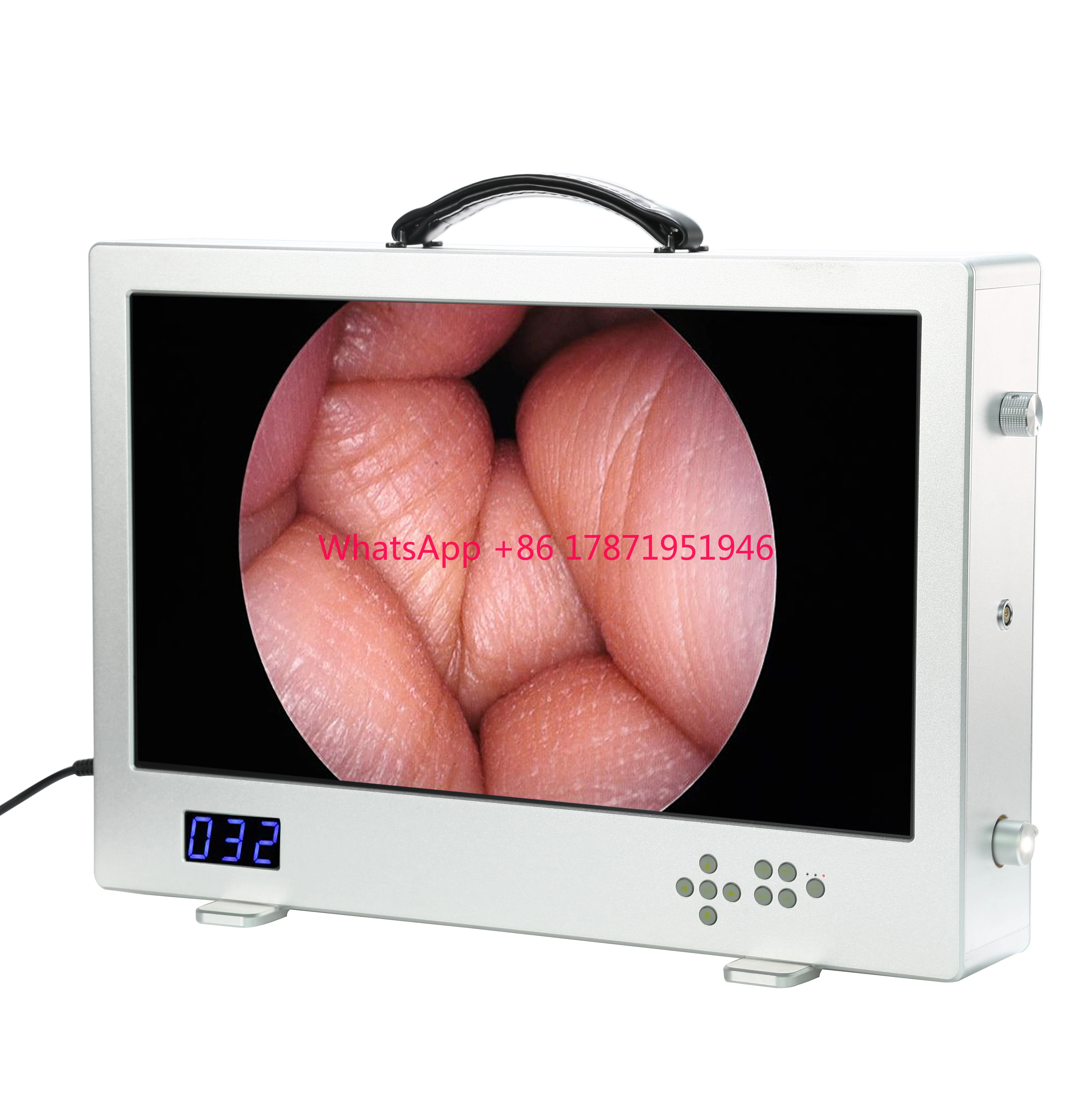 24 Inch 4IN1-VIDN-SET Integrated Endoscopic HD Camera System Medical Endoscope