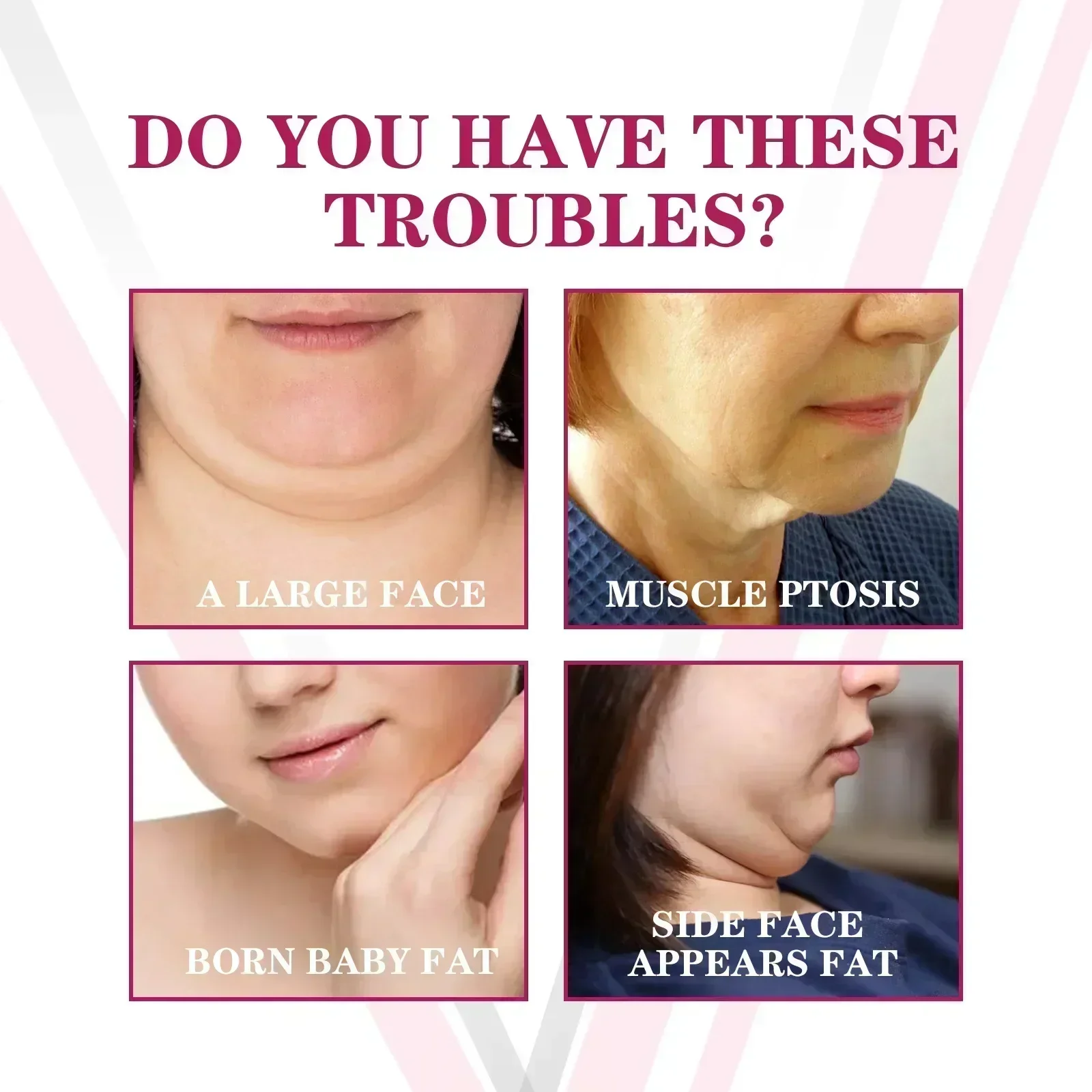 Face-lift V-Shaped Cream Removal Masseter Muscle Double Chin V Line Shape Face Firming Tighten Fat Burning Products