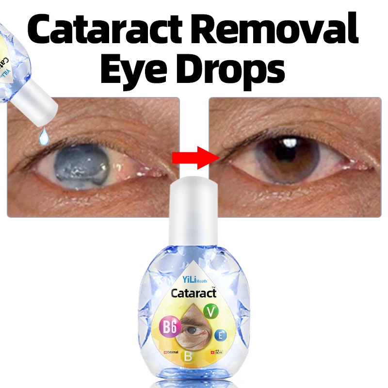 

Cataract Removal Eye Drops Vitamin B6 Improve Blurred Vision Eye Discomfort Glaucoma Presbyopia Treatment Eyes Drop 12Ml