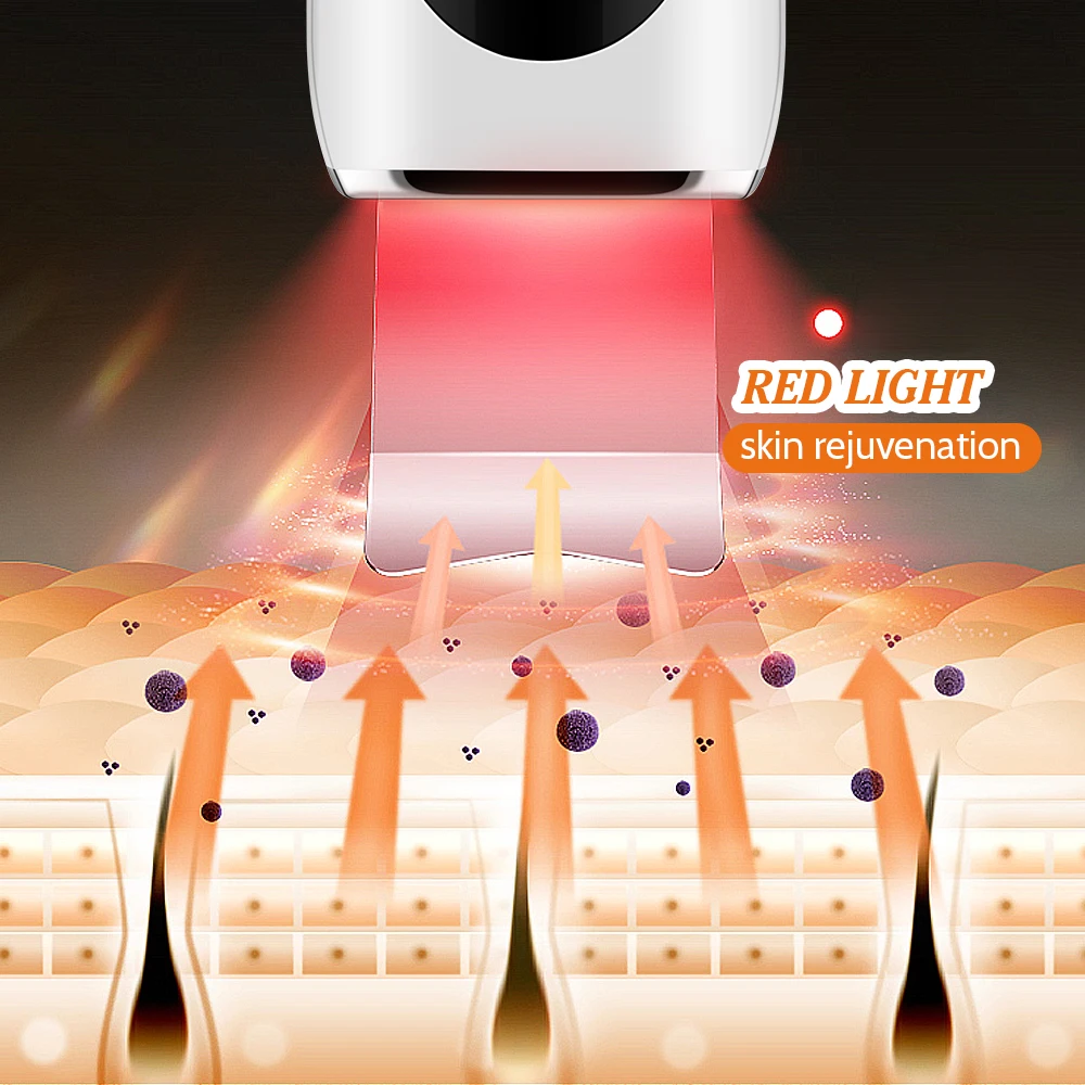 Ems Led Ultrasone Huid Scrubber Acne Naalden Set Deep Face Cleaning Lifting Peeling Machine Mee-Eter Remover Porie Cleaner