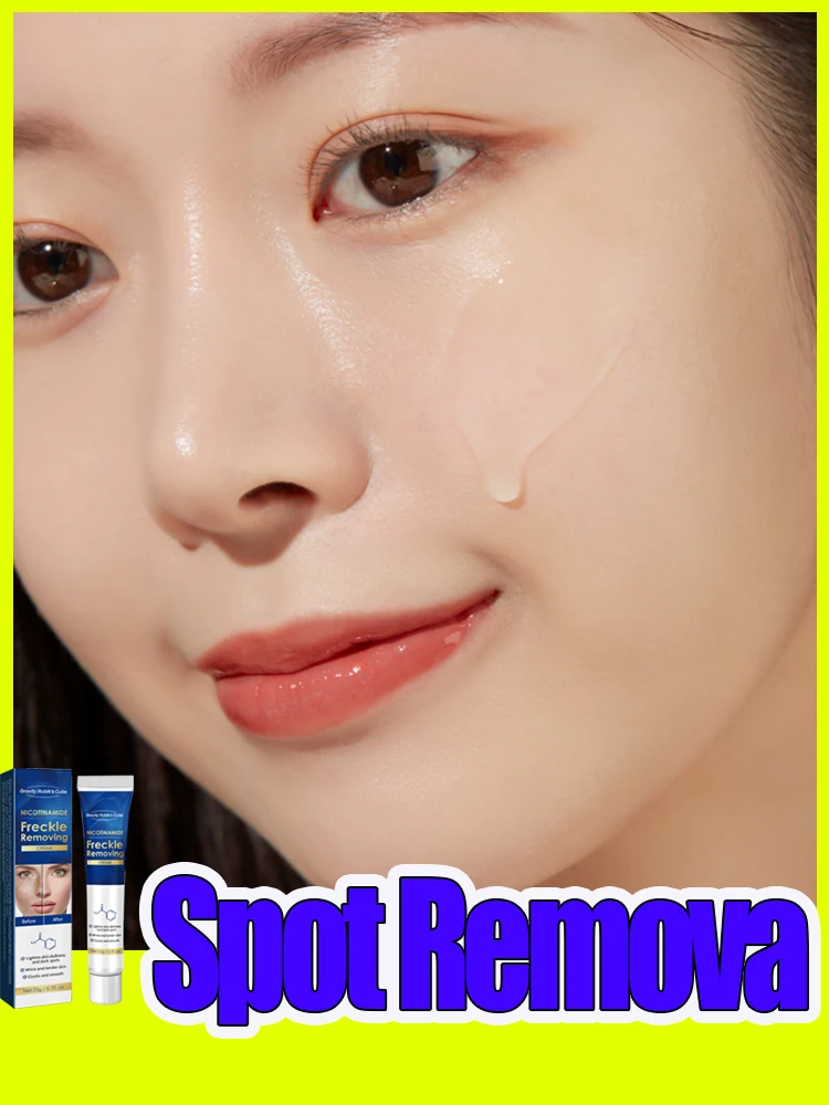 

Dark Spots Freckle Removal Blemish Melasma