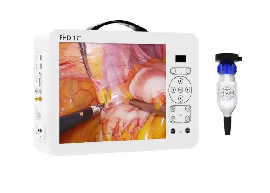 New Full HD 17 Inch All-in-One Portable Endoscopic Imaging Camera System For Rigid Endoscopic Otorhinolaryngology Urology