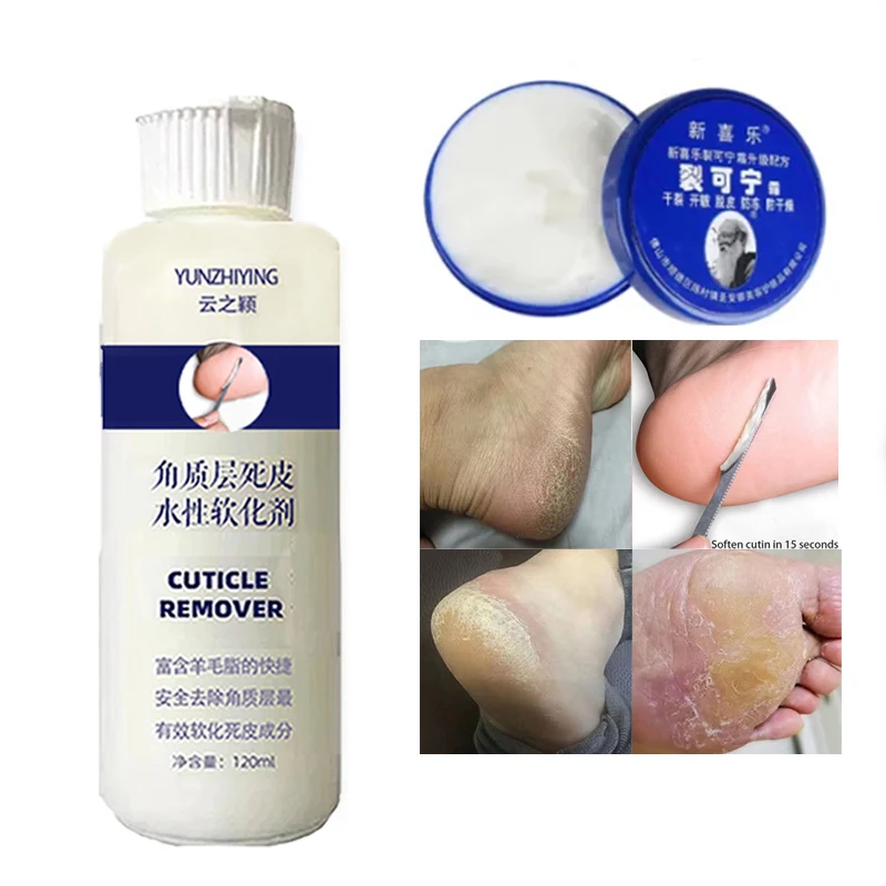 

Foot Exfoliation Softener Exfoliation Calluses Foot Mask Anti-crack Heel Enhancer Professional Nail Polishing Pedicure120ml Kit