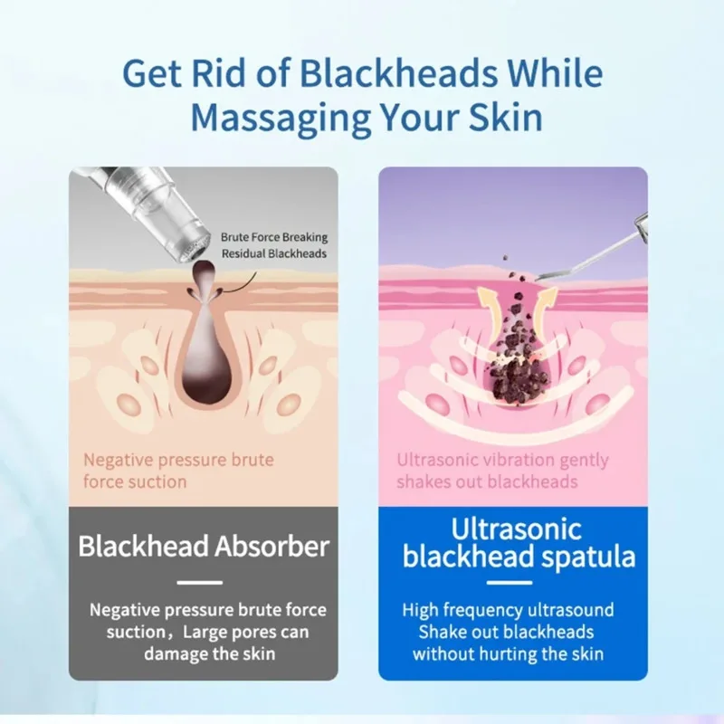 Neues Ultraschall-Schönheitsgerät, Porenreiniger, Gesichtsreiniger, Entferner, Mitesser-Reinigung, abgestorbene Haut, Akne, Gesichtsreiniger, Schönheitsmaschine