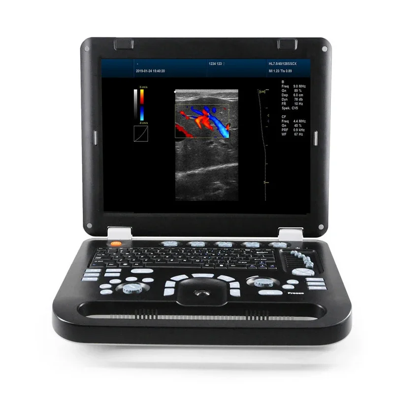 Hot sale Karestar high resolution large display color Doppler ultrasound machine