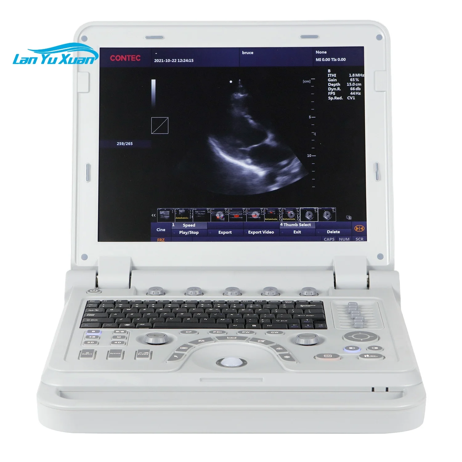 CMS1700B color doppler 3D 4D ultrasonic hospital portable diagnostic scanner ultrasound