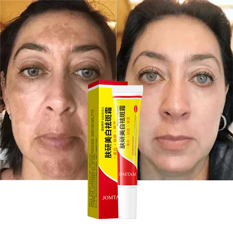 

Face Brightening Cream Niacinamide Reduce Melasma Melanin Brighten Cream Lighten Dark Skin Chloasma Serum Weaken Fine Lines Care