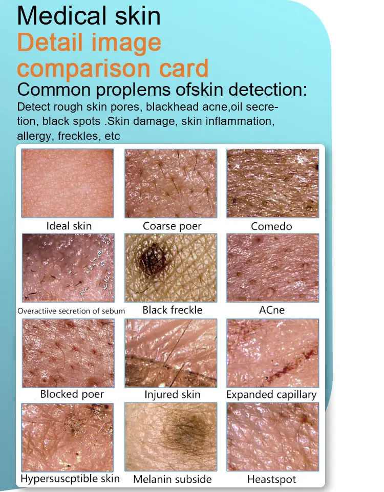 เครื่องสแกนหนังศีรษะ หน้า และรูขุมขน ตรวจสภาพผิวหนังและเส้นผมด้วยแสงยูวี สำหรับร้านเสริมสวยและสปา