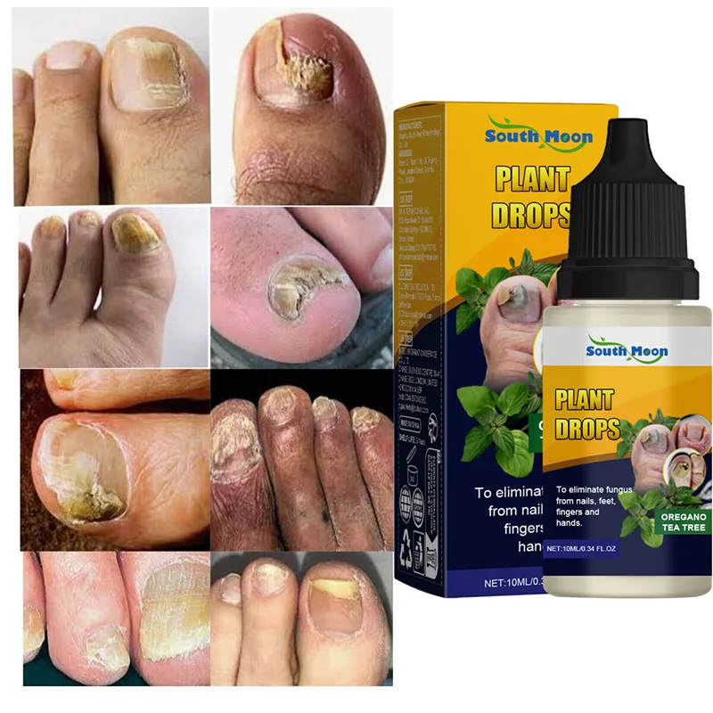 7 أيام علاجات فطريات الأظافر مصل سائل مضاد للعدوى فطار الداحس العناية باليدين الأظافر جل إزالة فطريات القدم #3