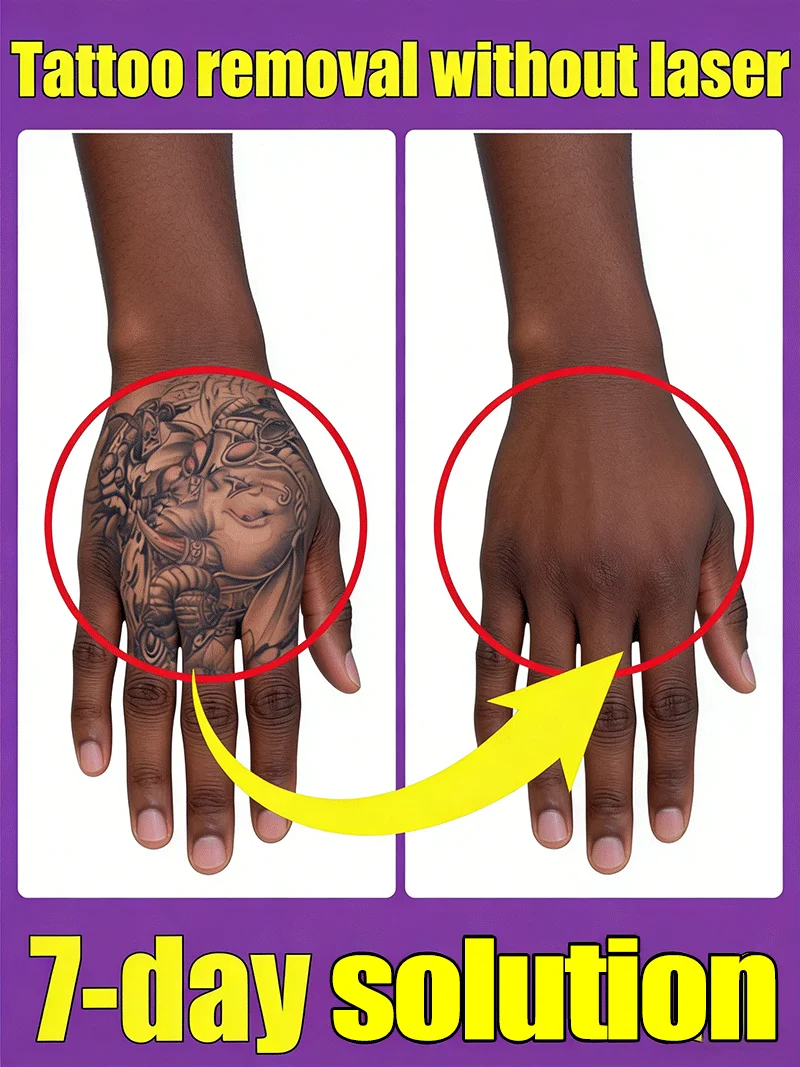 

Пигментированный перманентный макияж для удаления татуировок Быстрое удаление татуировок