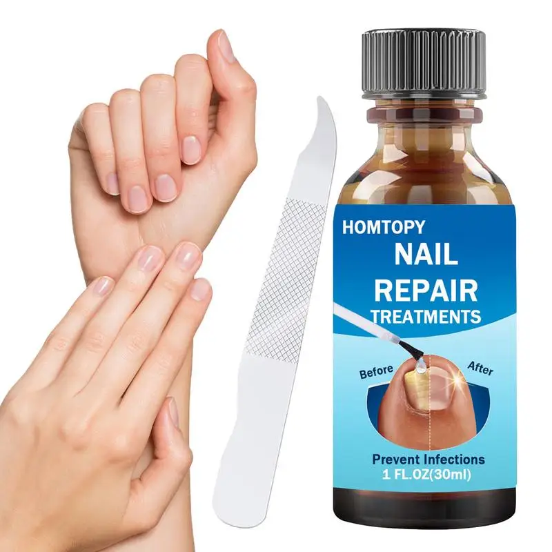 Nail Repair Solution Nail Strengthener Hand And Foot Nail Care Treat For Damaged Discolored Cracked Fingernails And Toenails