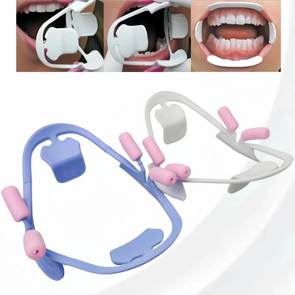 Professional Dental Mouth Opener and Lip Retractor Orthodontic Oral Prop for Precision Dentistry Lab Procedures