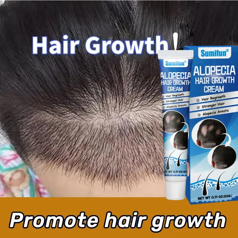 

7 days Fast Hair Growth Cream Anti Hair loss Prevent Baldness Scalp Treatment Repair Roots Beauty Health Hair Care For Men Women