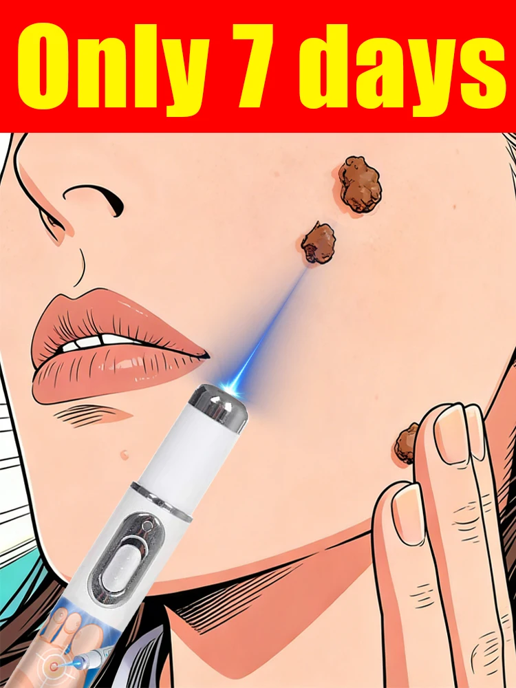 

2026 Безопасная, безболезненная и легко снимаемая, неинвазивная, портативная модель с аккумулятором: попрощайтесь с беспокойством по поводу внешнего вида.