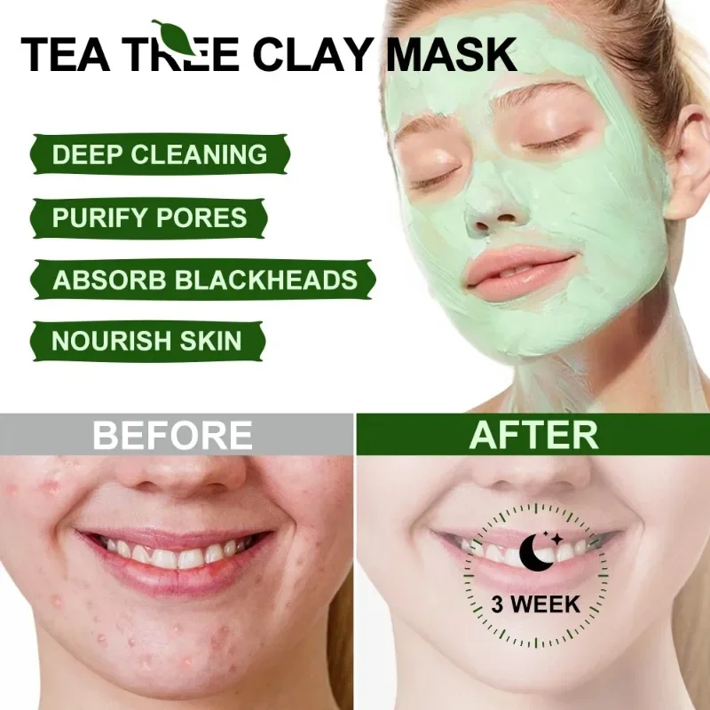 Green Tea Tree Clay Mask Remove Against Face Acne Treatment Cream Mask Facial Cleansing Black Dots Blackheads Remover Skin Care