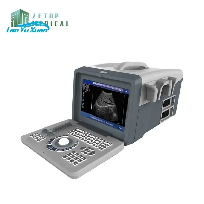 Hot Selling Clinic Use Cheapest Ultrasound Scan Machine Portable for Sale