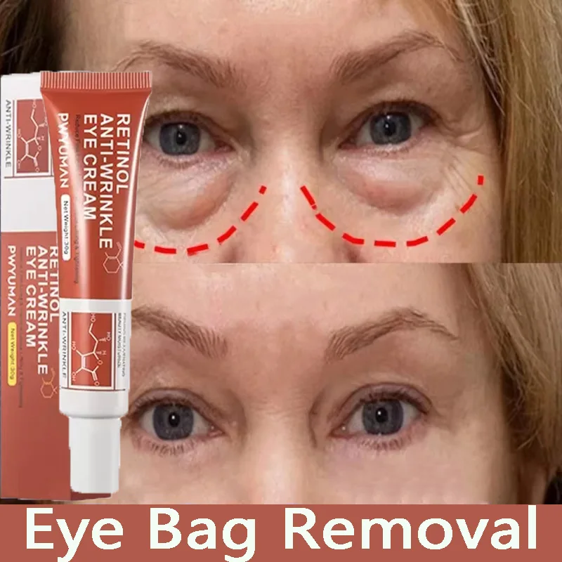 

Instant Eye Bag Removal Cream Retinol Anti-Wrinkle Fade Fine Lines Firm Skin Anti Dark Circles Puffiness Lift Brighten Eye Care