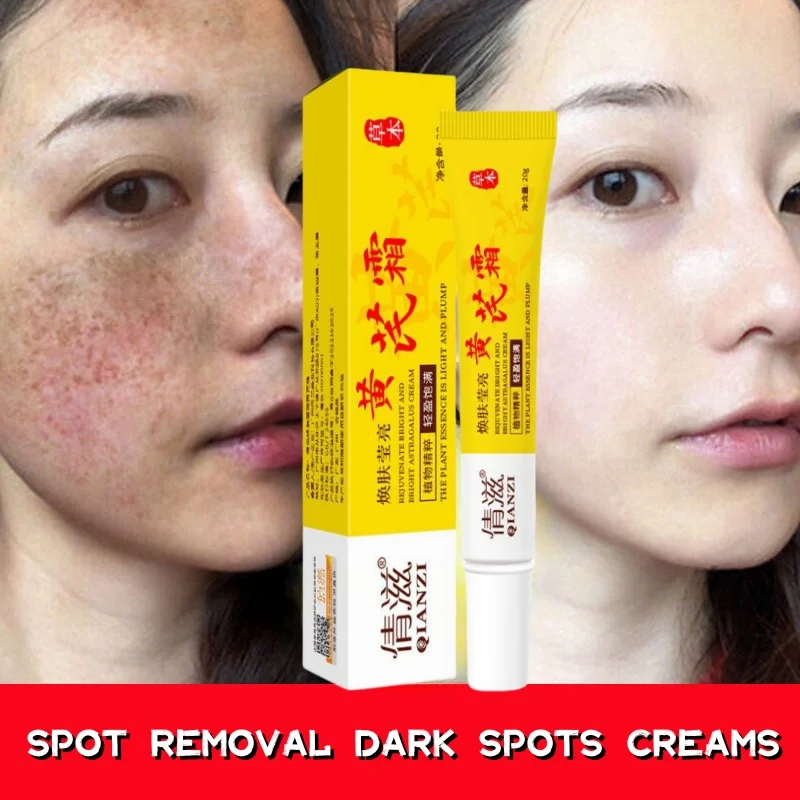 Face Brightening Cream Niacinamide Reduce Chloasma Melasma Melanin Fade Fine Lines Lighten Dark Skin Serum Care Brighten Cream