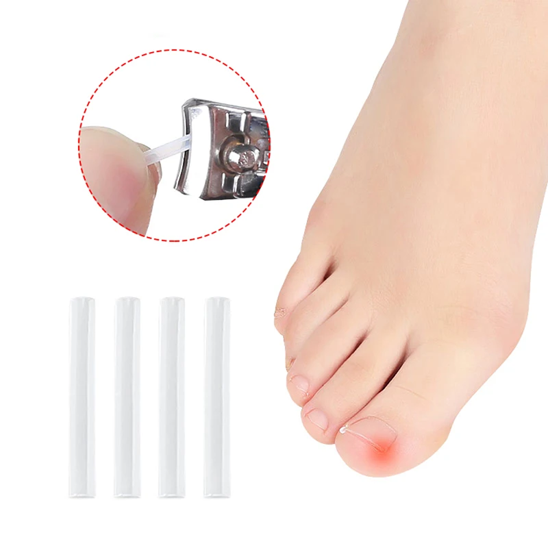 10pcs/pack Ingrown Toenail Correction Toenail Straightening Clip Tool Nail Treatment Elastic Patch Sticker Foot Care Pedicure