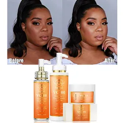 AILKE Vitamin C Bleaching Kit Für Frauen, Auch Haut Ton, Beruhigen, Reparatur, Feuchtigkeitsspendende, anti Falten & Aging, Radiance Haut Pflege