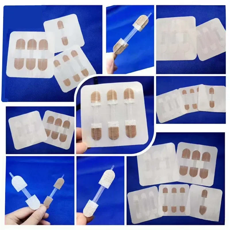 6Pcs 2Bags Zipper Tie Wound Closure Strip Hemostatic Patch Fast Suture Zipper Band-aid Wound Dressing Painless Wound Repair